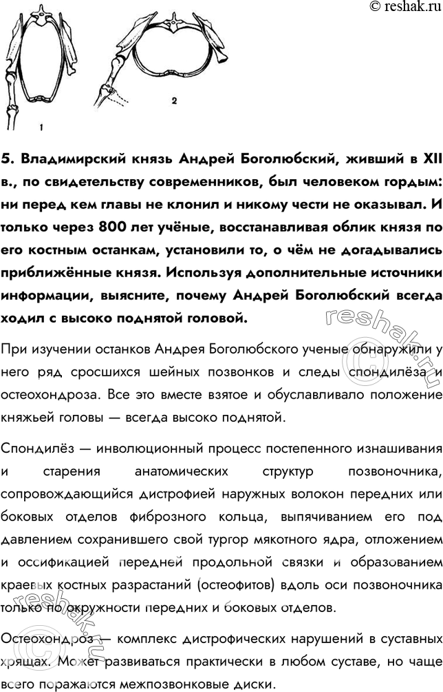 Решение задачи: §11. Скелет человека. Осевой скелет 1. Что такое скелет? Скелет – это совокупность костей, хрящей и укрепляющих их связок. 2. На какие части он подразделяется?